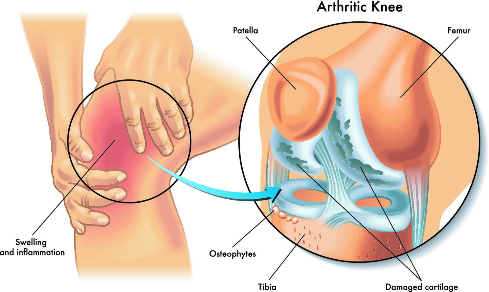 Športna prehrana kot del podpore zdravju